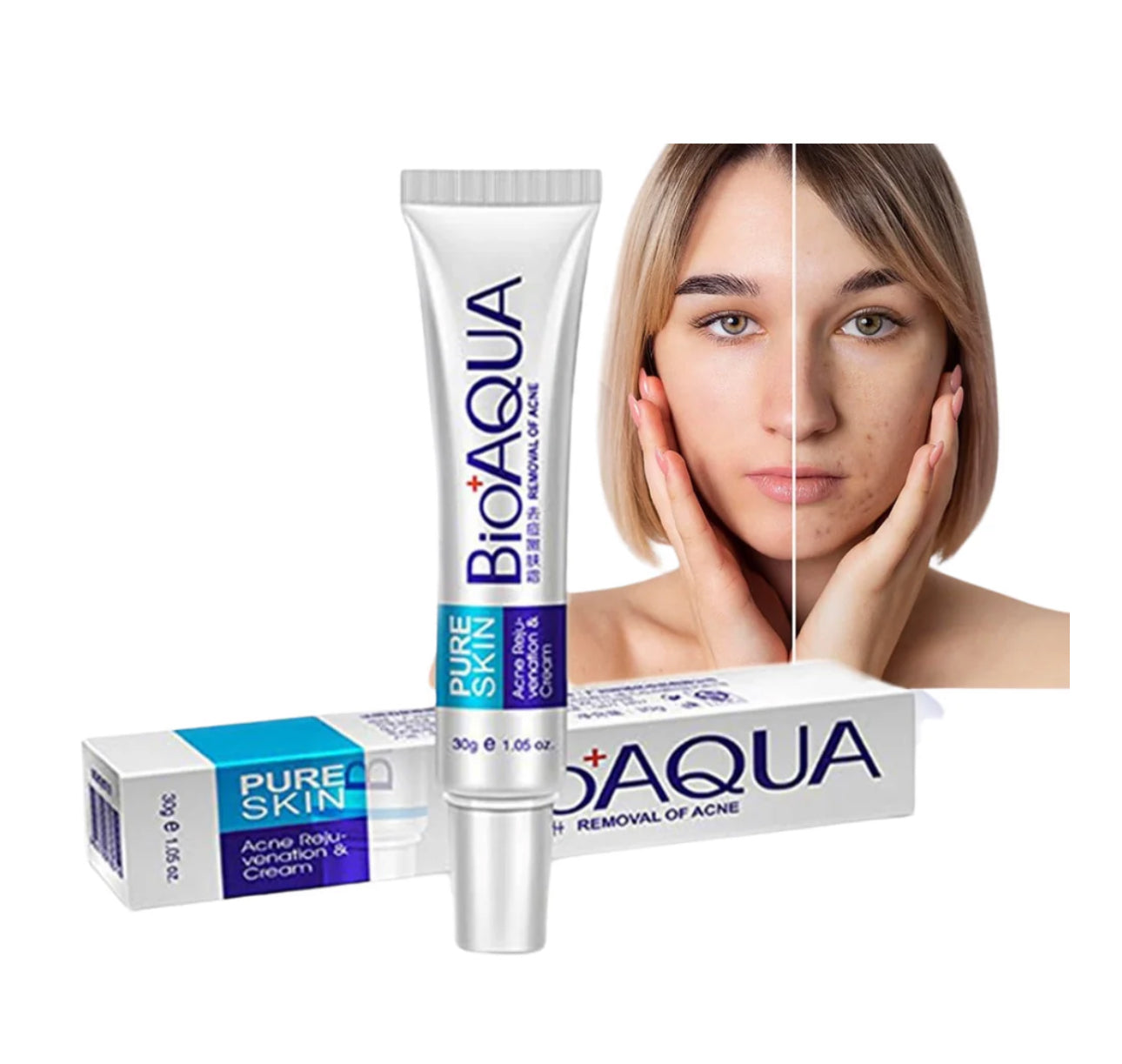 CREMA ANTIACNE BIOAQUA