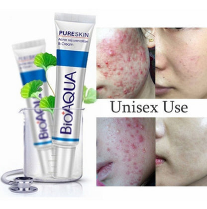 CREMA ANTIACNE BIOAQUA