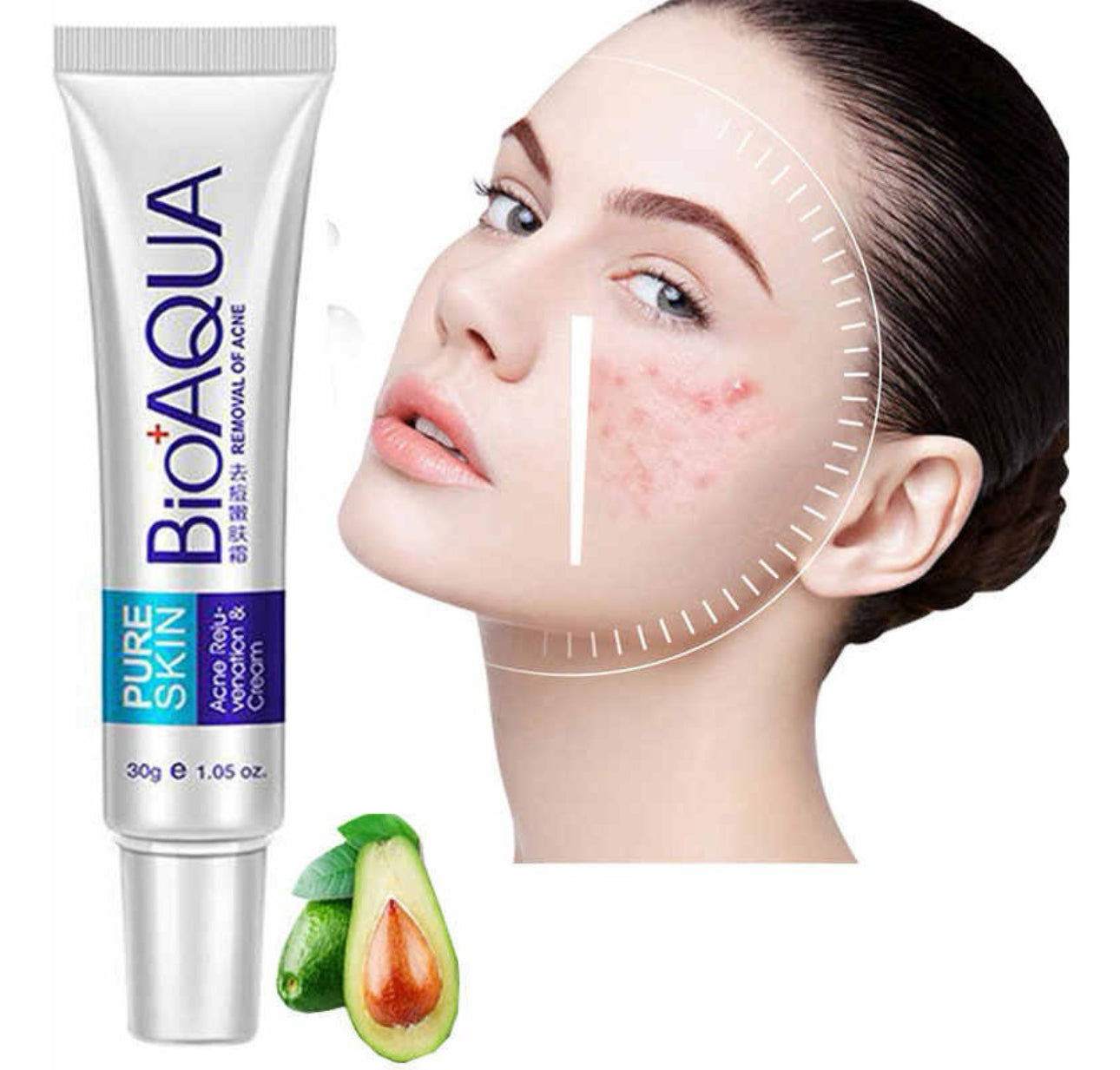 CREMA ANTIACNE BIOAQUA