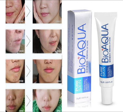 CREMA ANTIACNE BIOAQUA